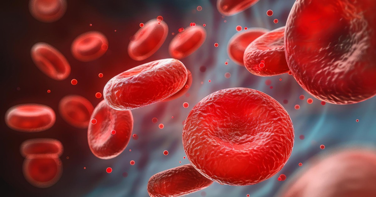 Understanding Anemia in Myelofibrosis. - Dr Daryl Tan in Singapore